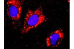 Proximity Ligation Analysis of protein-protein interactions between FLT1 and CTNNB1. (FLT1 Antikörper  (AA 1-687))