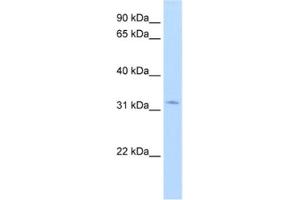 Western Blotting (WB) image for anti-Hydroxysteroid (17-Beta) Dehydrogenase 6 (HSD17B6) antibody (ABIN2462427) (HSD17B6 Antikörper)