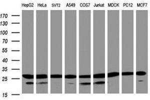 Image no. 3 for anti-Proteasome Subunit alpha 2 (PSMA2) (AA 50-234) antibody (ABIN1491567) (PSMA2 Antikörper  (AA 50-234))