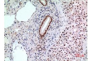 Immunohistochemistry (IHC) analysis of paraffin-embedded Human Liver, antibody was diluted at 1:100. (BCL6 Antikörper  (Internal Region))