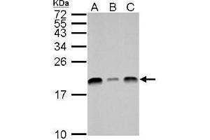 WB Image UBE2L3 antibody detects UBE2L3 protein by Western blot analysis.