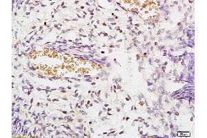 Formalin-fixed and paraffin embedded rat kidney labeled with Anti STK3/MST3 Polyclonal Antibody, Unconjugated (ABIN872978) at 1:200 followed by conjugation to the secondary antibody and DAB staining (STK3,STK4 (AA 101-200) Antikörper)