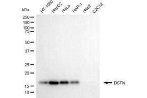 Western blotting analysis using DSTN antibody (ABIN7798321).