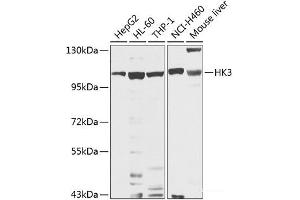 Western blot analysis of extracts of various cell lines using HK3 Polyclonal Antibody at dilution of 1:1000. (HK3 Antikörper)