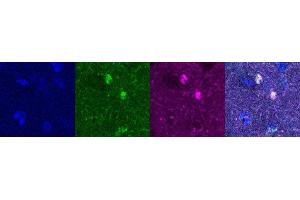 Immunohistochemistry (IHC) image for anti-Oligodendrocyte Lineage Transcription Factor 2 (OLIG2) antibody (ABIN7456250) (OLIG2 Antikörper)