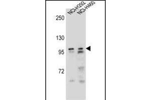 AR Antibody (Center) (ABIN656982 and ABIN2846165) western blot analysis in NCI-,NCI- cell line lysates (35 μg/lane). (Androgen Receptor Antikörper  (Center))
