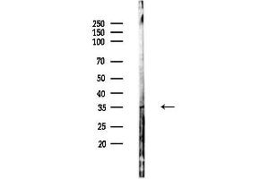Western blot analysis of lysates from PC12 cells, using Phospho-TIRAP (Tyr86) Antibody at 1/1000 dilution.