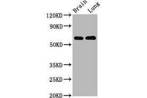 Western Blot Positive WB detected in: Rat brain tissue, Rat lung tissue All lanes: SELENON antibody at 4.