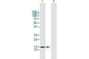 Western Blotting (WB) image for anti-Cyclin-Dependent Kinase Inhibitor 2C (p18, Inhibits CDK4) (CDKN2C) (AA 1-168) antibody (ABIN947693)