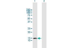 Western Blot analysis of CDKN2C expression in transfected 293T cell line by CDKN2C MaxPab polyclonal antibody. (CDKN2C Antikörper  (AA 1-168))