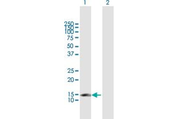 CDKN2C Antikörper  (AA 1-168)