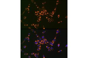 Immunofluorescence analysis of NIH-3T3 cells using ASL Rabbit pAb (ABIN6127448, ABIN6137201, ABIN6137202 and ABIN6221972) at dilution of 1:100 (40x lens). (ASL Antikörper  (AA 1-300))
