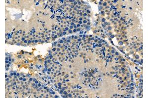 ABIN6257551 and ABIN6275682 at 1/100 staining Mouse testis tissue by IHC-P. (WASF2 Antikörper  (Internal Region))