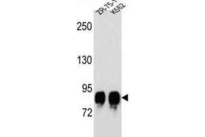 Western Blotting (WB) image for anti-Protein-O-Mannosyltransferase 1 (POMT1) antibody (ABIN2996702) (POMT1 Antikörper)