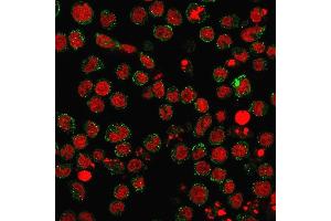 Immunofluorescence staining of U937 cells using CD15 Rabbit Recombinant Monoclonal Antibody (FUT4/1478R) followed by goat anti-Mouse IgG conjugated to CF488 (green). (Rekombinanter CD15 Antikörper)