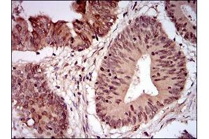 Immunohistochemistry (IHC) image for anti-Nibrin (NBN) (AA 467-615) antibody (ABIN1724942)