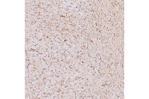 IHC analysis of SGCE using anti-SGCE antibody (ABIN7601544). (SGCE Antikörper  (AA 38-407))