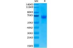 Human PD-1 on Tris-Bis PAGE under reduced. (PD-1 Protein (AA 25-167) (Fc Tag))