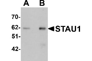 Western Blotting (WB) image for anti-Staufen Double-Stranded RNA Binding Protein 1 (STAU1) (C-Term) antibody (ABIN1030702) (STAU1/Staufen Antikörper  (C-Term))