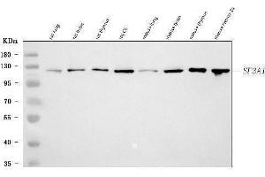 Western blot analysis of SF3A1 using anti-SF3A1 antibody (ABIN7600556). (SF3A1 Antikörper  (AA 20-556))