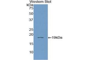 Western blot analysis of recombinant Human IL11Ra. (IL11RA Antikörper  (AA 59-220))