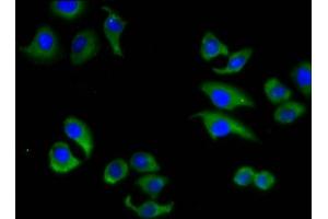 Immunofluorescence staining of A549 cells with ABIN7160322 at 1:133, counter-stained with DAPI. (ABCC6 Antikörper  (AA 730-931))