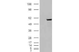 Western Blotting (WB) image for anti-Fumarate Hydratase (FH) (Internal Region) antibody (ABIN2465736) (FH Antikörper  (Internal Region))