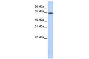 Image no. 1 for anti-UPF3 Regulator of Nonsense Transcripts Homolog B (UPF3B) (AA 252-301) antibody (ABIN6740708)