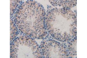 Used in DAB staining on fromalin fixed paraffin- embedded Kidney tissue (GNG8 Antikörper  (AA 1-70))