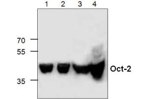 Western Blot analysis of Oct-2 expression in Lysates from Jukat cells (Lanes 1+2), 3T3 cells (Lane 3) and Rat Kidney (Lane 4). (Oct-2 Antikörper  (C-Term))
