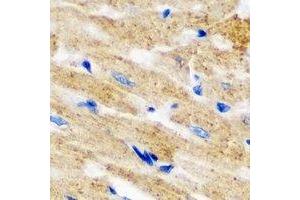Immunohistochemical analysis of L2HGDH staining in mouse heart formalin fixed paraffin embedded tissue section.