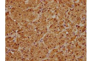 IHC image of ABIN7170757 diluted at 1:100 and staining in paraffin-embedded human adrenal gland tissue performed on a Leica BondTM system. (CYP21A2 Antikörper  (AA 312-418))