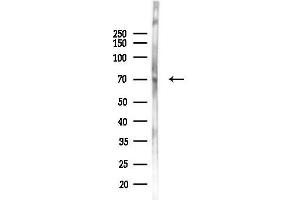 Western blot analysis of lysates from Mouse liver, using TRPV6 Antibody at 1/1000 dilution.