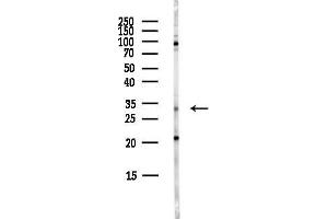 anti-GS Homeobox 2 (GSX2) antibody