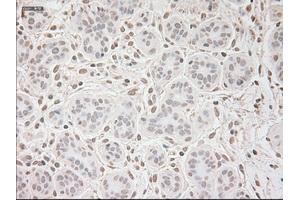 Immunohistochemical staining of paraffin-embedded breast tissue using anti-VEGF mouse monoclonal antibody. (VEGF Antikörper  (AA 27-233))