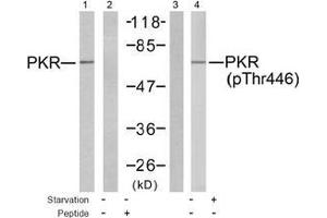 Image no. 2 for anti-Eukaryotic Translation Initiation Factor 2-alpha Kinase 2 (EIF2AK2) (pThr446) antibody (ABIN197048) (EIF2AK2 Antikörper  (pThr446))