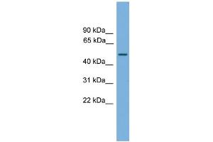 WB Suggested Anti-CPA6 Antibody Titration: 0. (CPA6 Antikörper  (Middle Region))