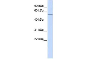 ACVR1C antibody used at 1 ug/ml to detect target protein. (ACVR1C/ALK7 Antikörper  (N-Term))