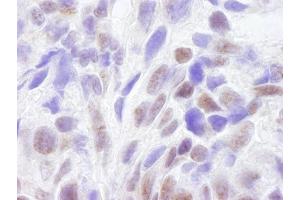 Immunohistochemistry (IHC) image for anti-CREB Binding Protein (CREBBP) (AA 2375-2425) antibody (ABIN7448459) (CBP Antikörper  (AA 2375-2425))
