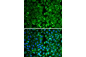 Immunofluorescence analysis of MCF-7 cells using RUNX3 antibody (ABIN4905075). (RUNX3 Antikörper)