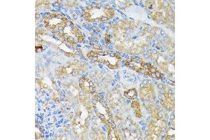 Immunohistochemistry of paraffin-embedded mouse kidney using R Rabbit mAb (ABIN7269840) at dilution of 1:100 (40x lens). (RALBP1 Antikörper)