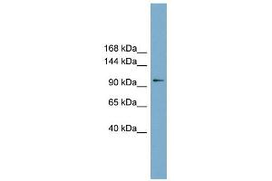 FTSJD1 antibody used at 1 ug/ml to detect target protein. (CMTR2 Antikörper  (Middle Region))