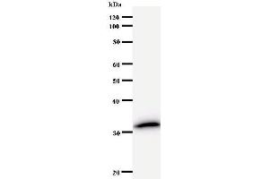 Western Blotting (WB) image for anti-N(alpha)-Acetyltransferase 38, NatC Auxiliary Subunit (NAA38) antibody (ABIN931019) (NAA38 Antikörper)