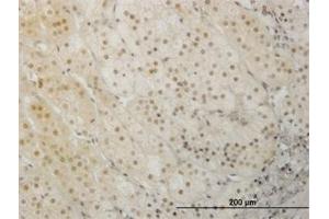 Image no. 3 for anti-LIM Homeobox 1 (LHX1) (AA 1-101) antibody (ABIN598782) (LHX1 Antikörper  (AA 1-101))