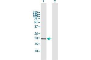 Western Blot analysis of SSH2 expression in transfected 293T cell line by SSH2 MaxPab polyclonal antibody. (SSH2 Antikörper  (AA 1-178))