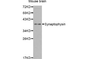 Western blot analysis of extracts of mouse brain, using SYP antibody. (Synaptophysin Antikörper)