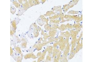 Immunohistochemistry of paraffin-embedded Rat heart using NAT2 Polyclonal Antibody at dilution of 1:100 (40x lens). (NAT2 Antikörper)