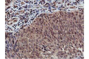 Image no. 2 for anti-V-Akt Murine Thymoma Viral Oncogene Homolog 1 (AKT1) antibody (ABIN1496556) (AKT1 Antikörper)