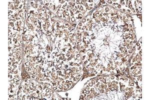 IHC-P Image DYNC1I2 antibody detects DYNC1I2 protein at cytosol on mouse testis by immunohistochemical analysis. (DYNC1I2 Antikörper)