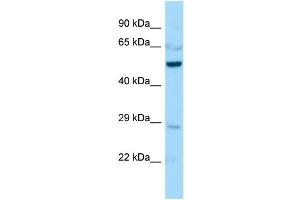 Host:  Rabbit  Target Name:  Creld1  Sample Type:  Mouse Lung lysates  Antibody Dilution:  1. (CRELD1 Antikörper  (Middle Region))